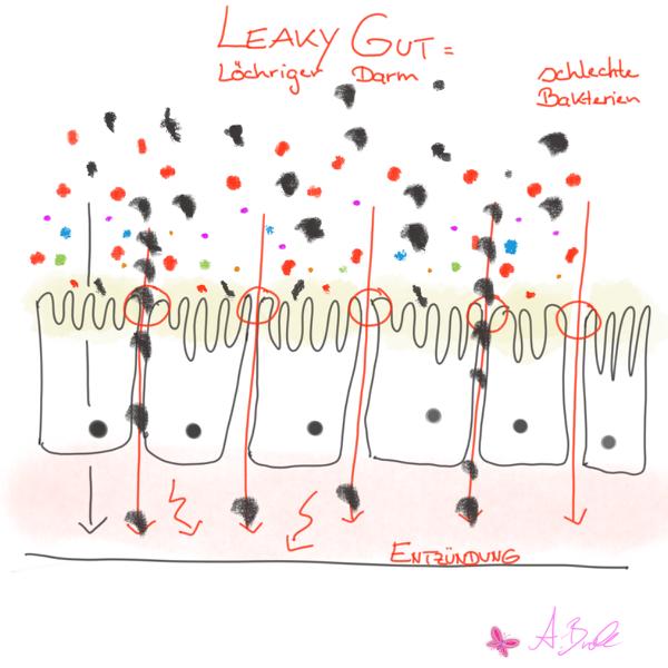 Leaky Gut